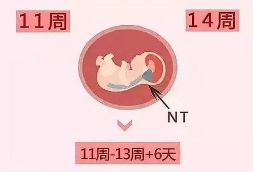 NT值能分辨男女吗？怀孕12周的NT值是否提示男女？