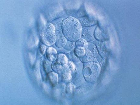 菏泽les供卵中介-这些是决定是否用囊胚养育优势胚胎的最重要因素，在做决定前了解这些因素是很重要的